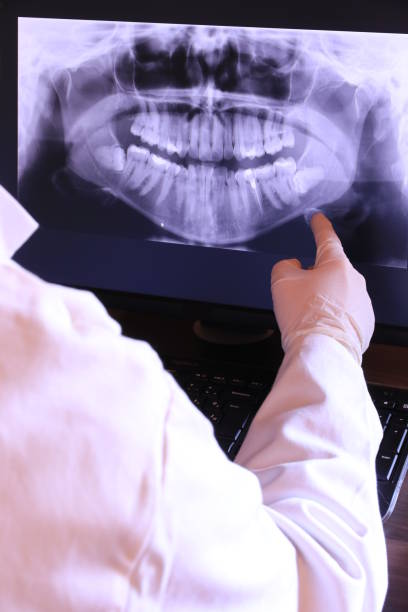 Best Emergency Dental Care for Abscessed Tooth in Mendon, UT